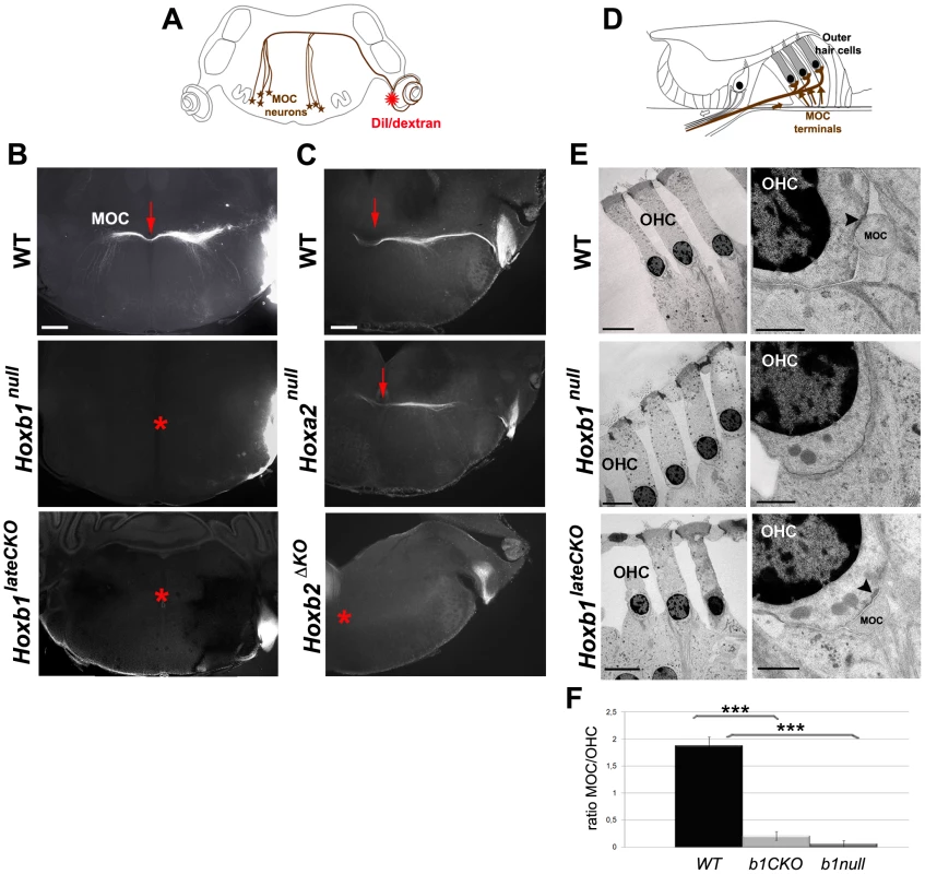 Affected connectivity of medial olivocochlear (MOC) neurons in <i>Hoxb1 and Hoxb2</i> mutant mice.