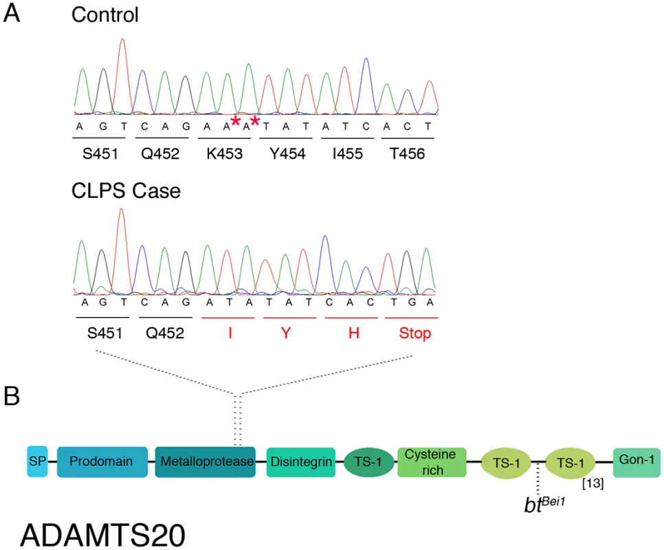 Characterization of <i>ADAMTS20</i> mutation in NSDTRs.
