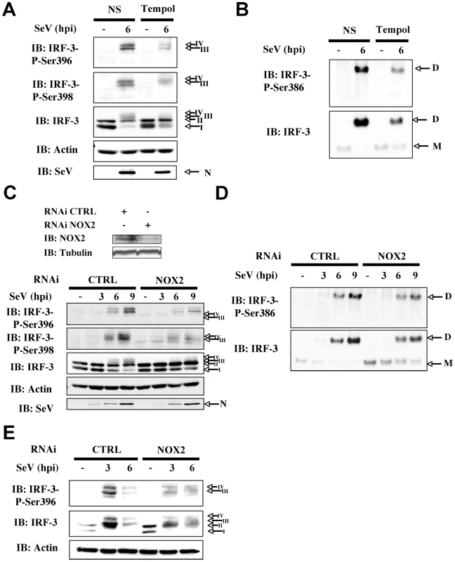 Knockdown of NOX2 expression impairs SeV-induced C-terminal IRF-3 phosphorylation and dimerization in A549 and human primary NHBE.