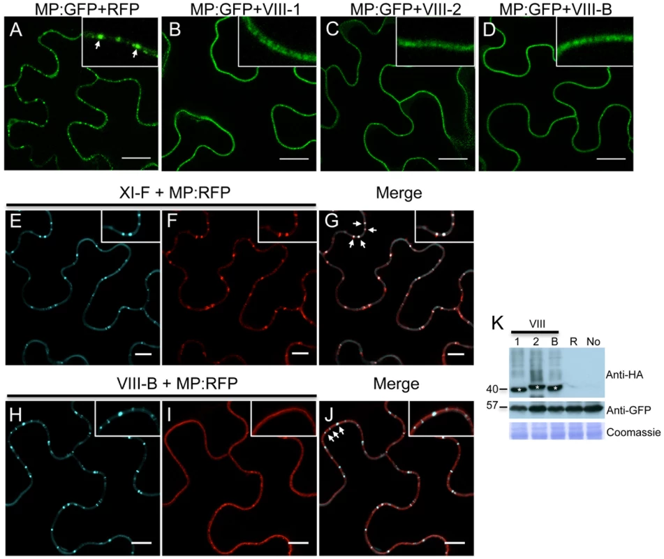 Inactivation of myosin VIII-1, VIII-2 or VIII-B disrupts the PD localization of MP.