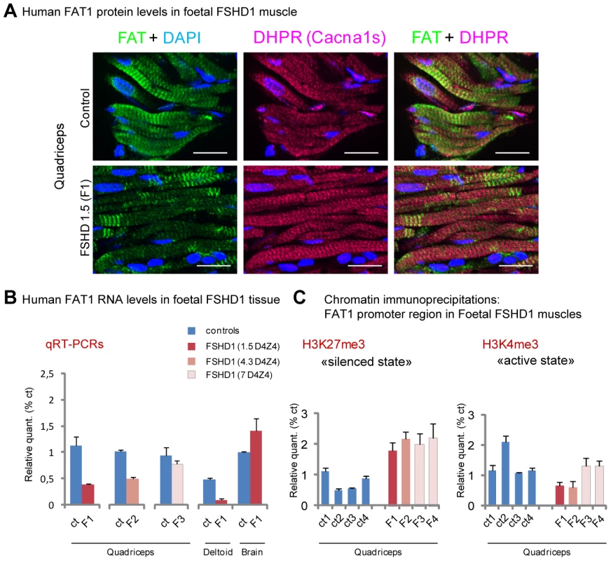 FAT1 protein and RNA levels are mis-regulated in human foetal FSHD tissues.