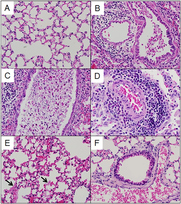 Lung pathology in select preCC mice.