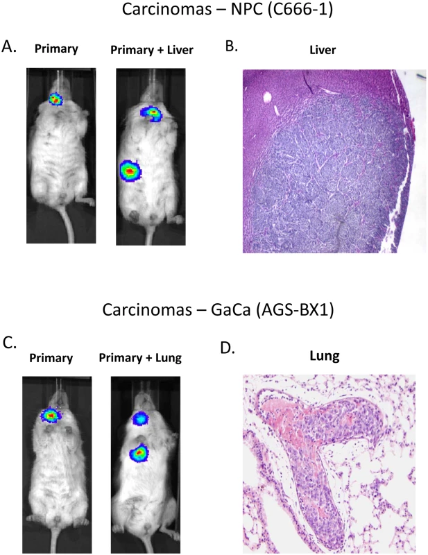 Mouse models of EBV positive carcinoma.