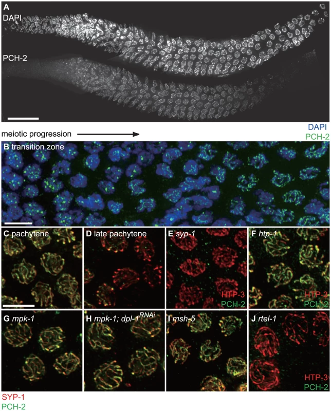 PCH-2 localizes to the SC when inter-homolog DNA repair mechanisms are active.
