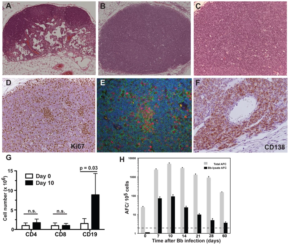 <i>B. burgdorferi</i>-induced lymphadenopathy is caused by a massive proliferation and differentiation of lymph node B cells.