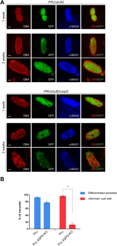 Cyst wall formation is affected in type II parasites lacking ASP5.