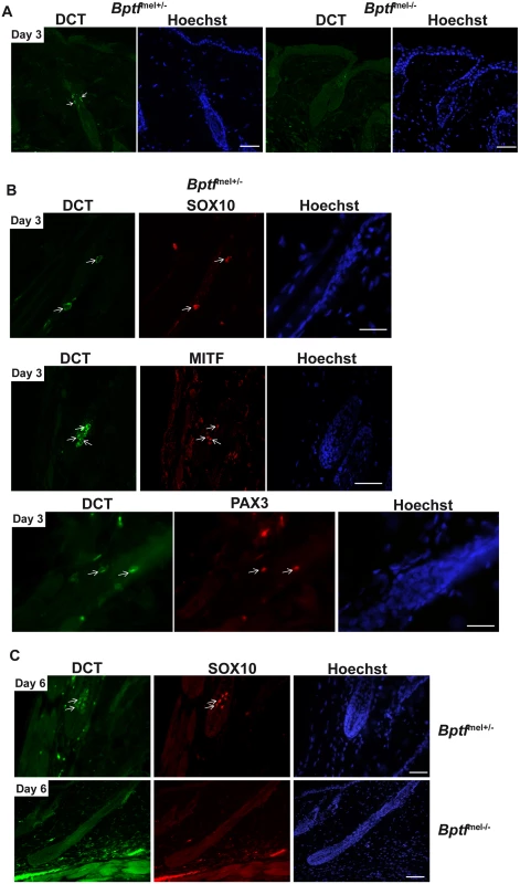 Bptf acts upstream of Mitf in differentiating adult melanocytes.