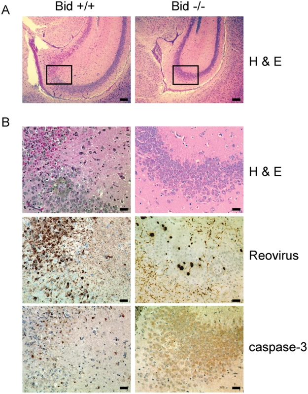 Reovirus-induced histopathologic injury is diminished in the CNS of Bid-deficient mice.