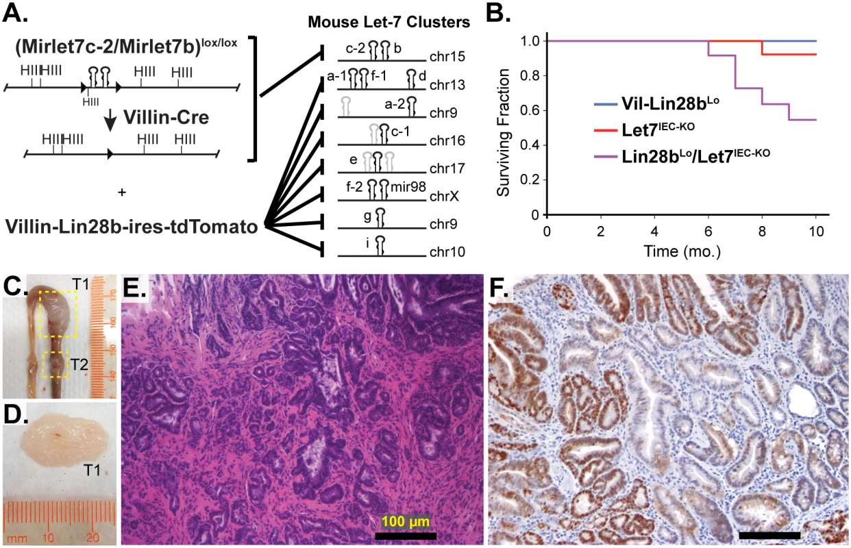 Comprehensive depletion of all Let-7 miRNAs leads to the development of intestinal adenocarcinomas.