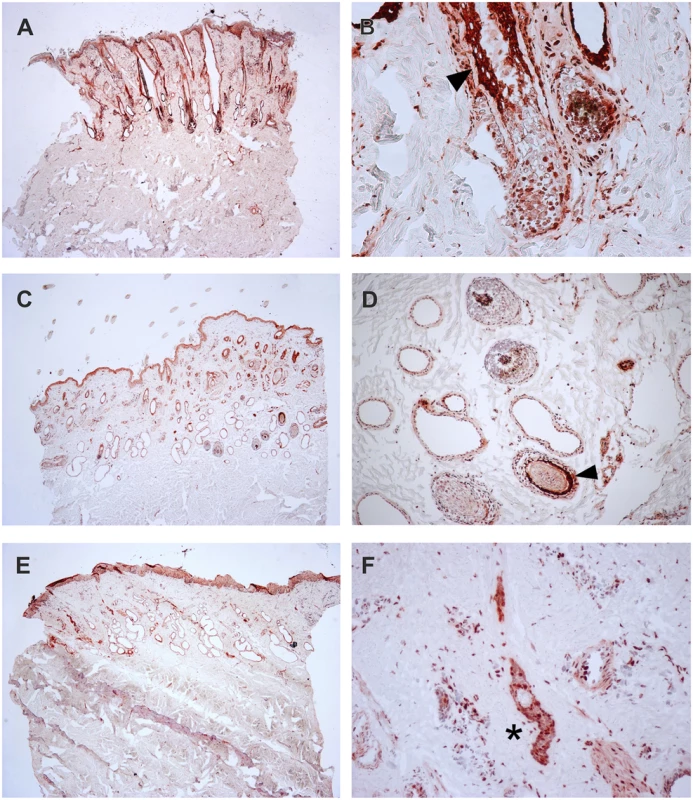 Expression of TSR2 protein in adult bovine skin.