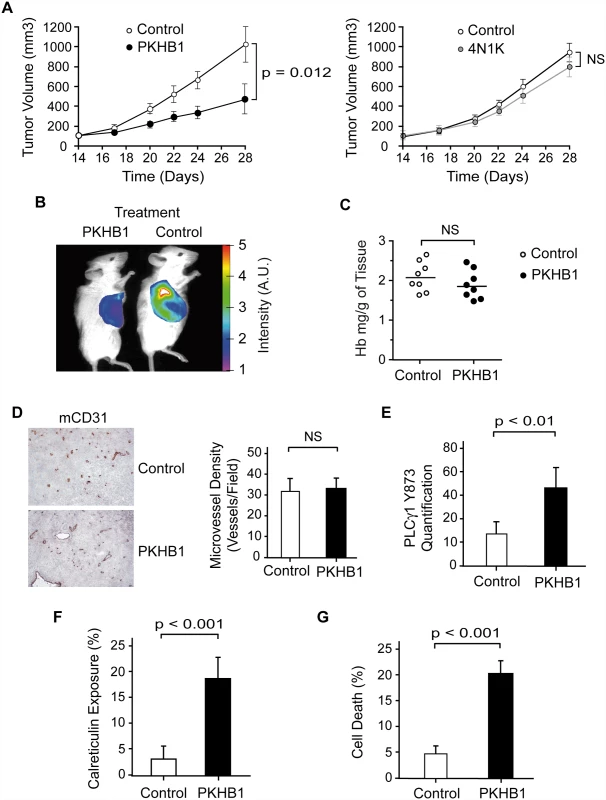 PKHB1 reduced <i>in vivo</i> CLL tumor burden by inducing PLCγ1 activation and PCD.