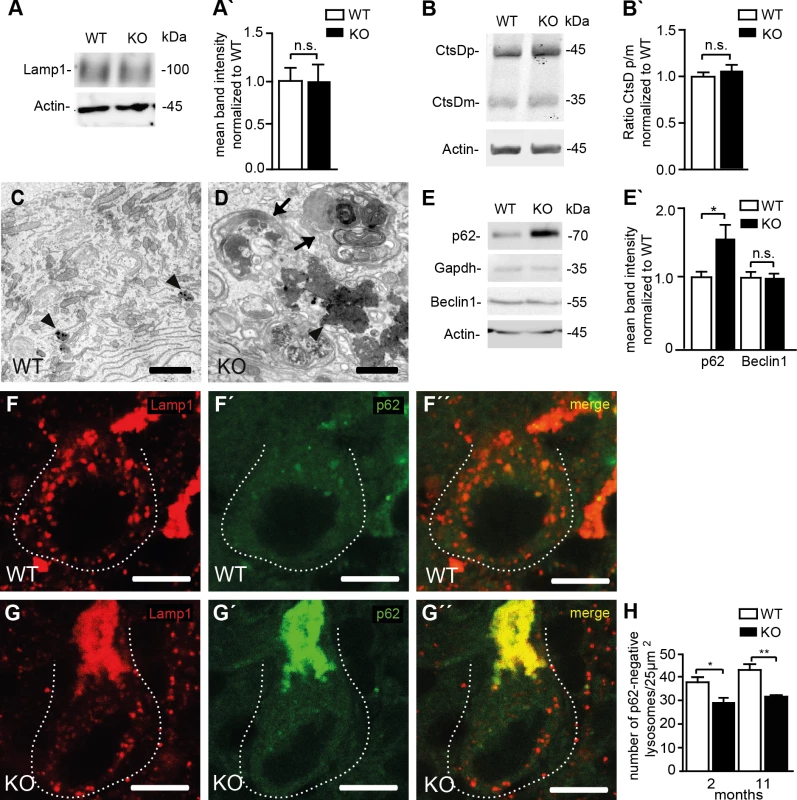 Reduced lysosome numbers in Purkinje cells of Spatacsin knockout mice are consistent with impaired autophagic lysosome reformation.