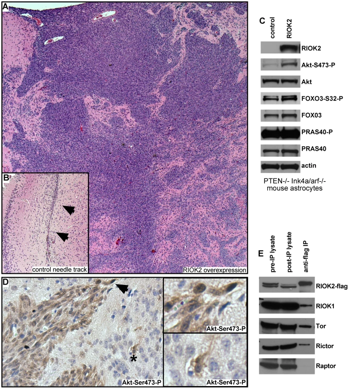 Overexpression of RIOK2 in murine astrocytes promotes tumorigenesis and TORC2-Akt signaling.