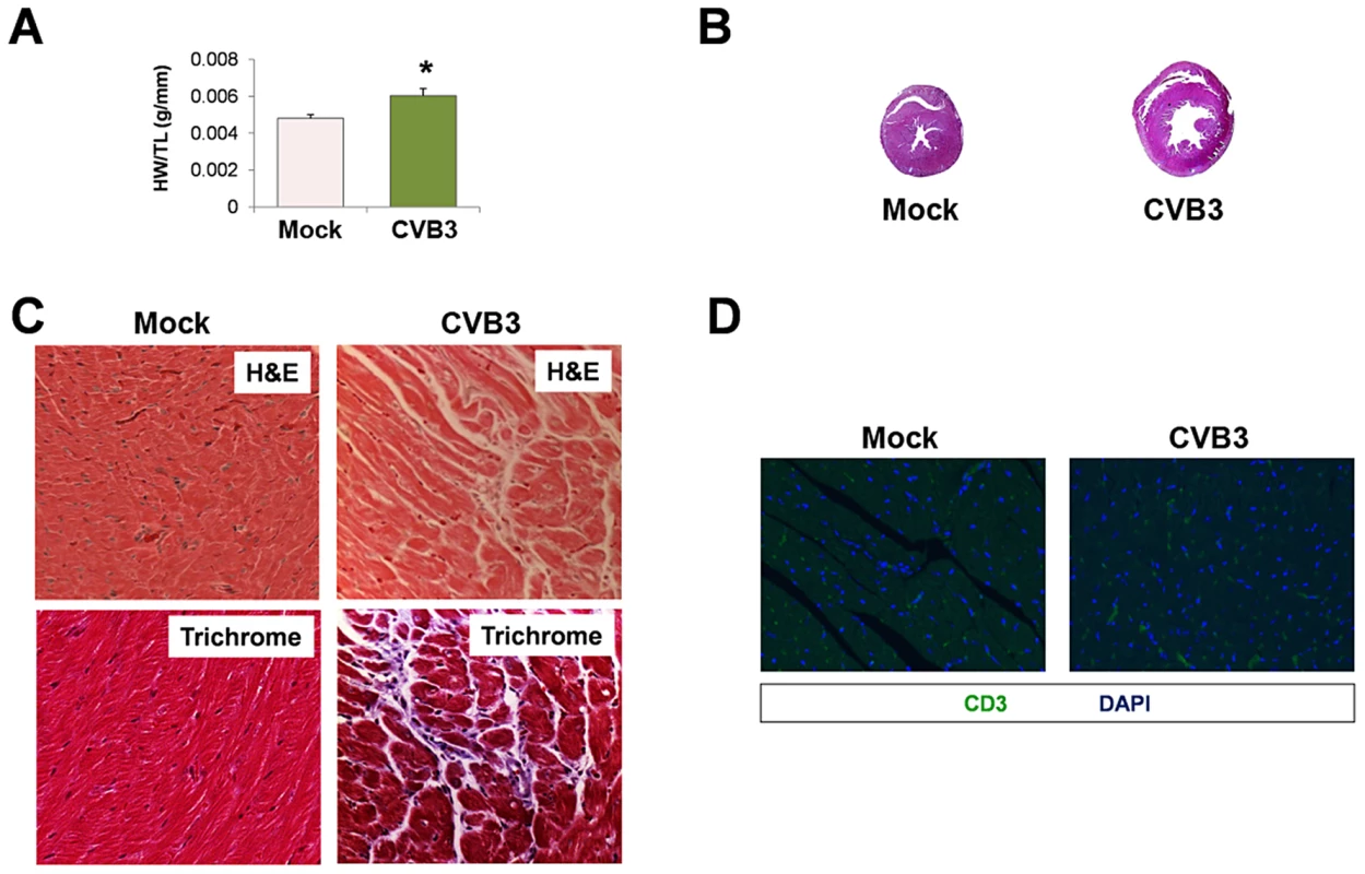 Exercise-induced cardiac hypertrophy in adult mice infected with CVB3 at an early age leads to dilated cardiomyopathy.