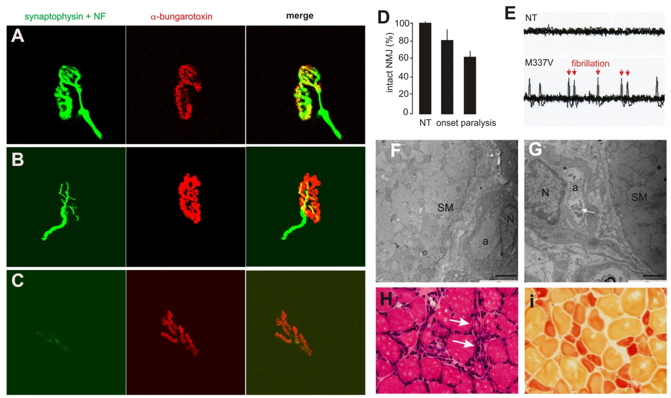 Denervation atrophy of skeletal muscle in transgenic rats expressing a mutant human <i>TDP</i> gene.