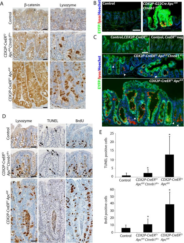 Inactivation of a <i>Ctnnb1</i> allele in mouse colon epithelium reduces apoptosis and hyperproliferation induced by bi-allelic <i>Apc</i> inactivation, and also reduces, but does not abrogate, the aberrant cell differentiation associated with <i>Apc</i> inactivation.