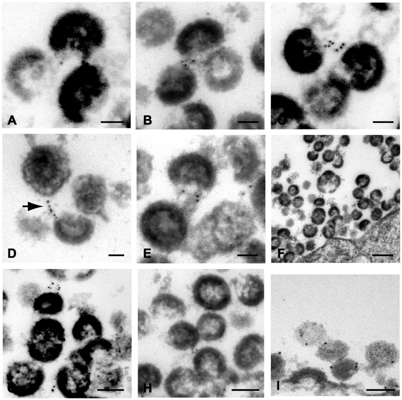 Immunoelectron micrographic analysis of indinavir-treated, NL4.3/Udel-infected A3.01 cells demonstrating inter-virion connections.