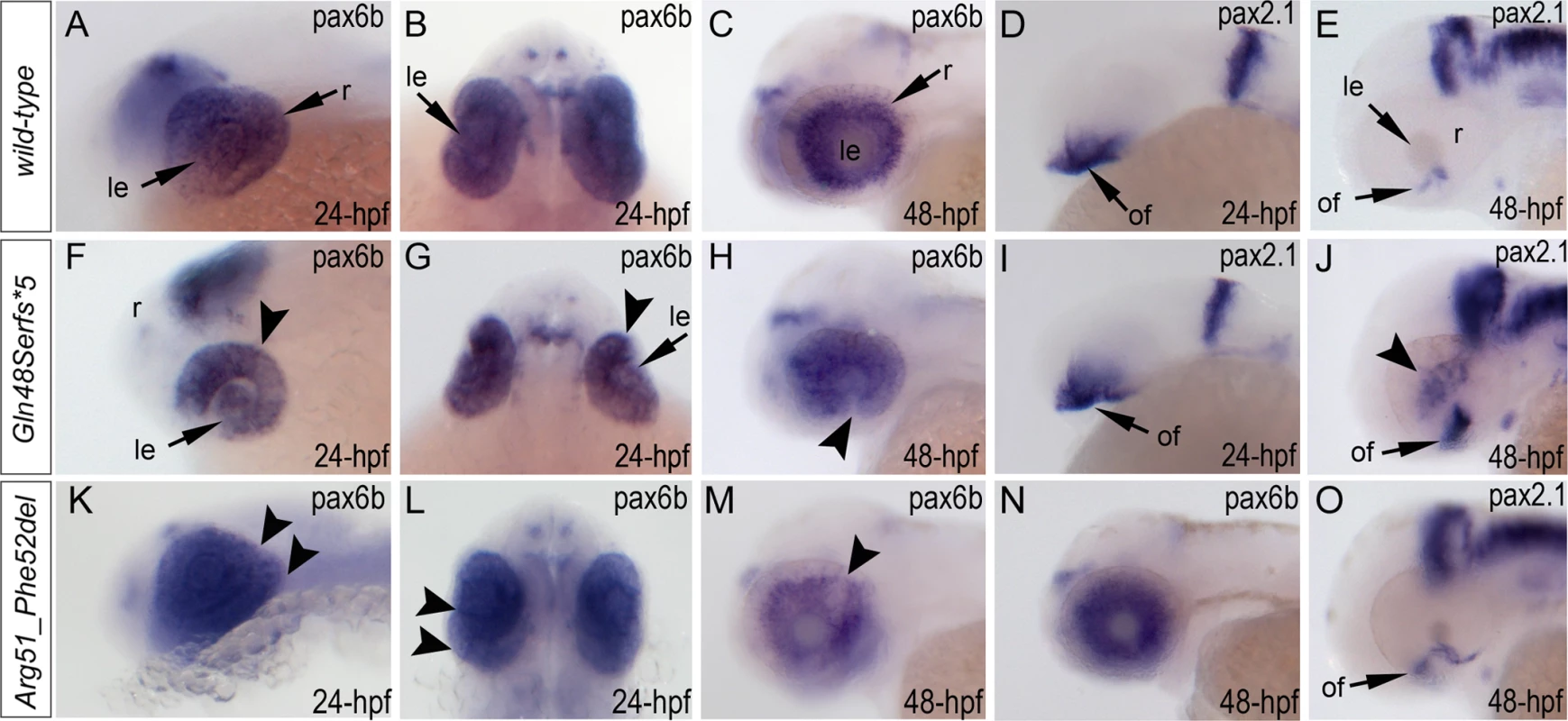 Analysis of <i>pax6b</i>, <i>pax2</i>.<i>1</i> and <i>foxe3</i> expression in wild-type, <i>mab21l2</i><sup><i>Q48Sfs*5</i></sup> and <i>mab21l2</i><sup><i>R51_F52del</i></sup> embryos.