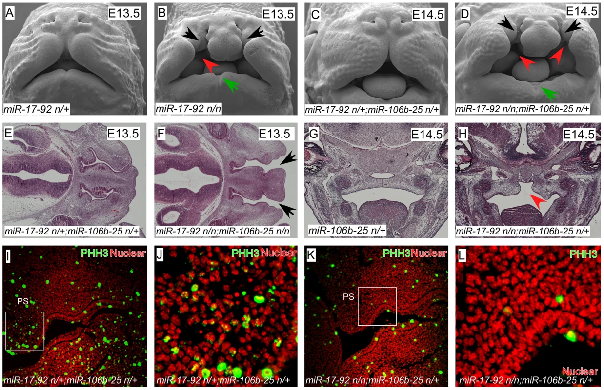 <i>miR-17-92</i> cluster is required for midface and palate morphogenesis.