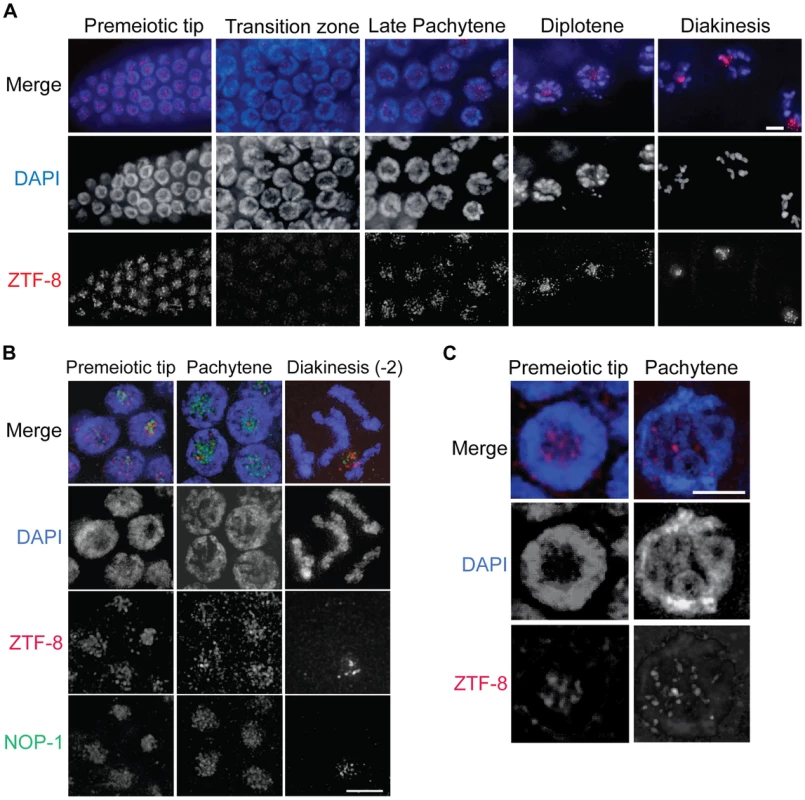 ZTF-8 is expressed in both mitotic and meiotic nuclei.