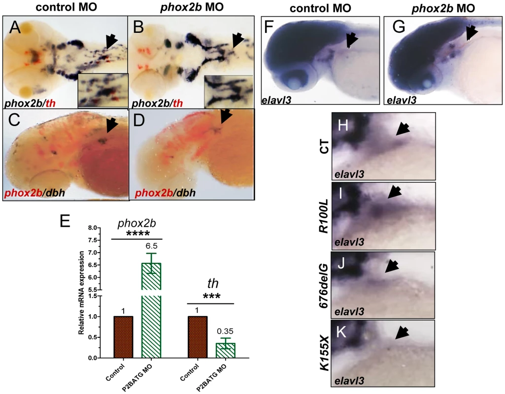 Phox2b deficiency causes arrest of SCG cells at an undifferentiated stage.