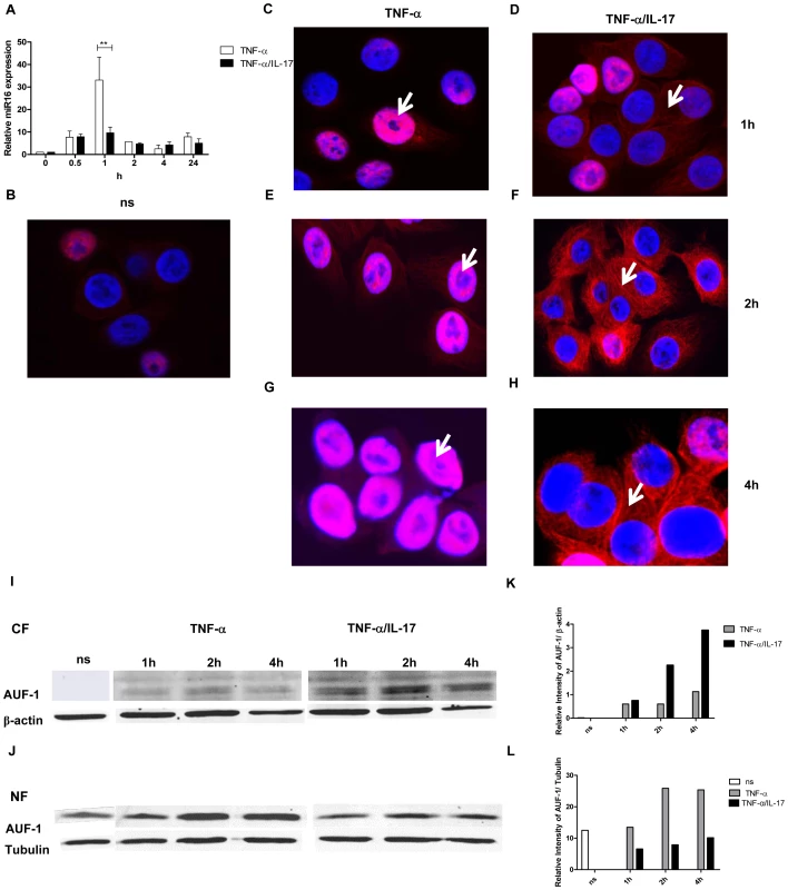 IL-17 limits miR16 expression and promotes cytoplasmic localization of AUF-1.