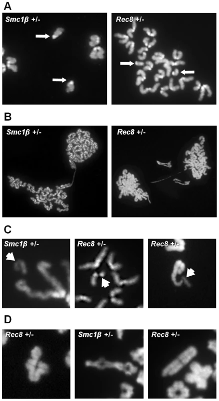Chromosome abnormalities are increased in cohesin heterozygotes.