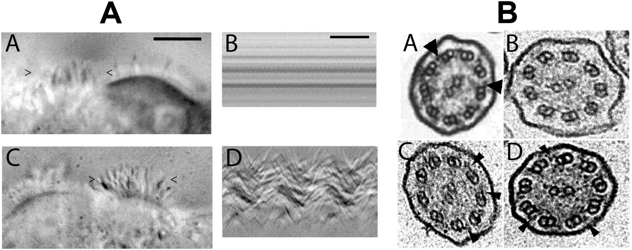 Images of transduced <i>DNAI1</i>–mutated HAECs and electron microscopic sections of cilia.