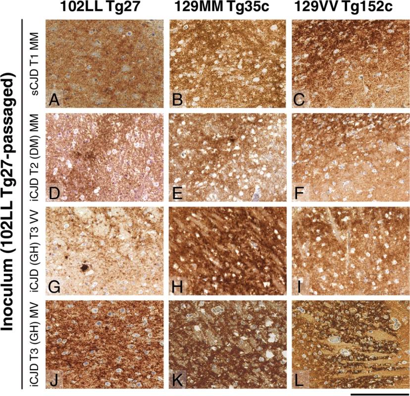 Immunohistochemical detection of abnormal PrP deposition in brains of transgenic mice challenged with CJD-102L prions.