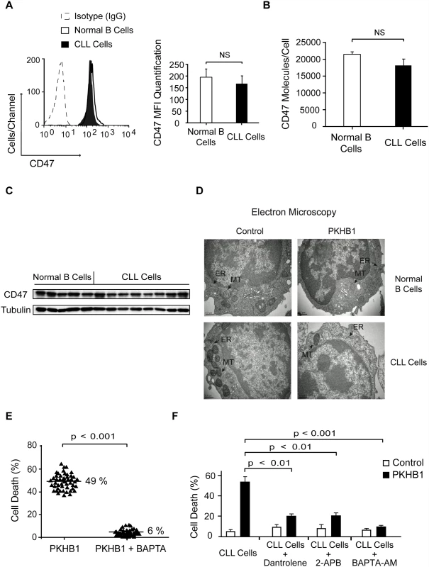 PKHB1 generates endoplasmic reticulum stress that provokes Ca<sup>2+</sup>-mediated PCD in the CLL cells.