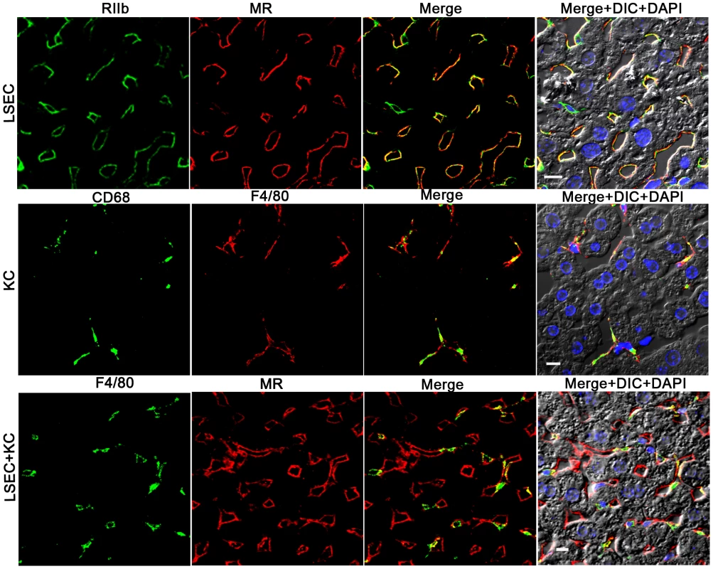Three-color immunofluorescence images showing LSEC and KC markers in mouse liver.