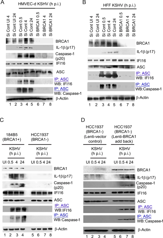 Analysis demonstrating that BRCA1 is essential for IFI16 inflammasome activation.