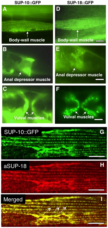 SUP-18 is expressed predominantly in muscles and co-localizes subcellularly with SUP-10.
