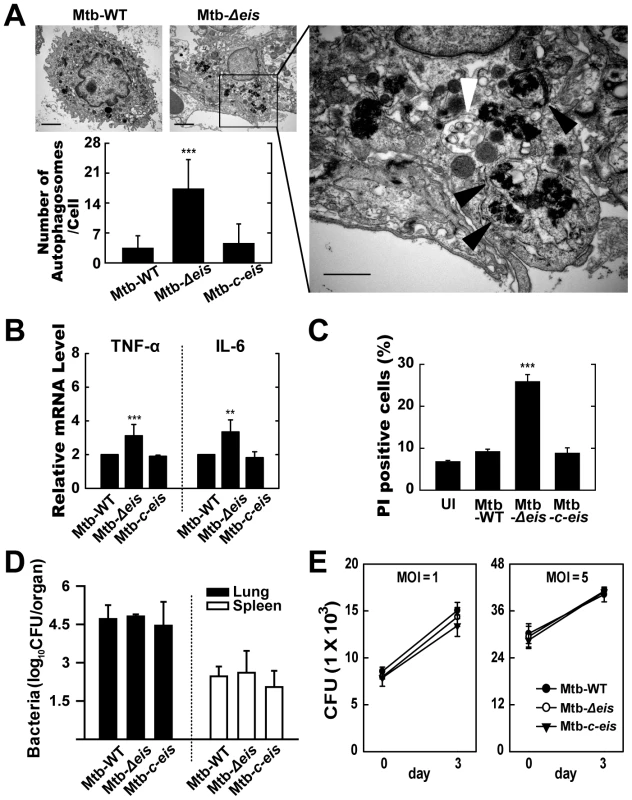 <i>In vivo</i> analysis of autophagic vesicles, inflammation, and cell death in infected mice with Mtb-<i>Δeis</i>.