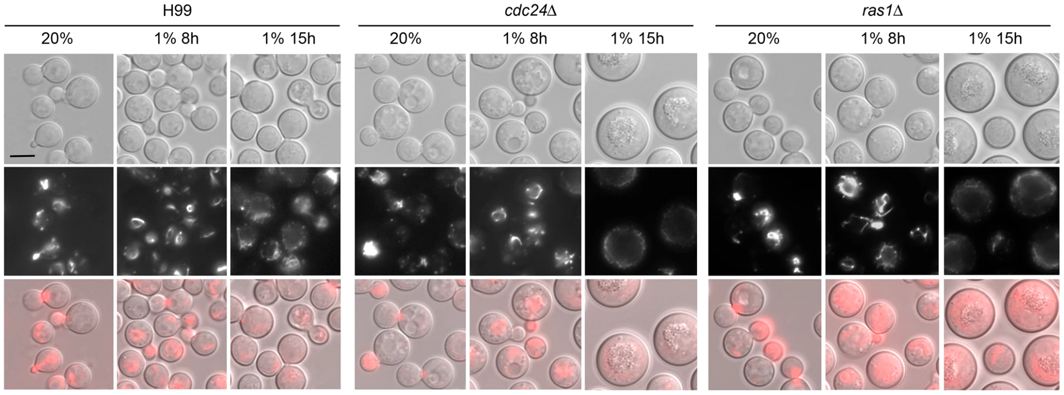 Actin polarization is not clearly influenced by <i>cdc24Δ</i> and <i>ras1Δ</i> in hypoxic conditions.