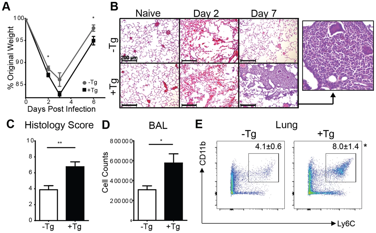 Expression of hResistin exacerbates lung inflammation.