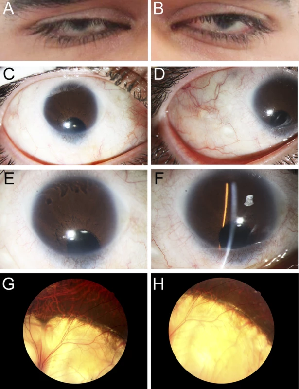 Ocular Images of Patient 1.