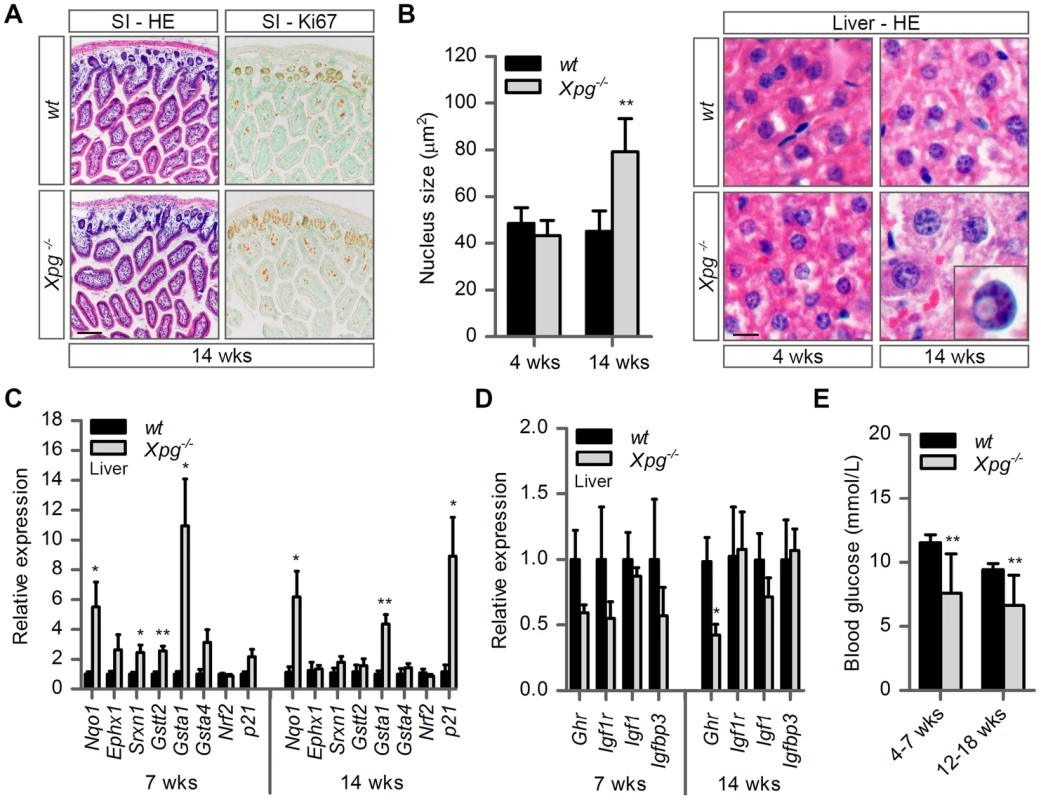 Intestine and liver phenotype of <i>Xpg<sup>−/−</sup></i> mice.