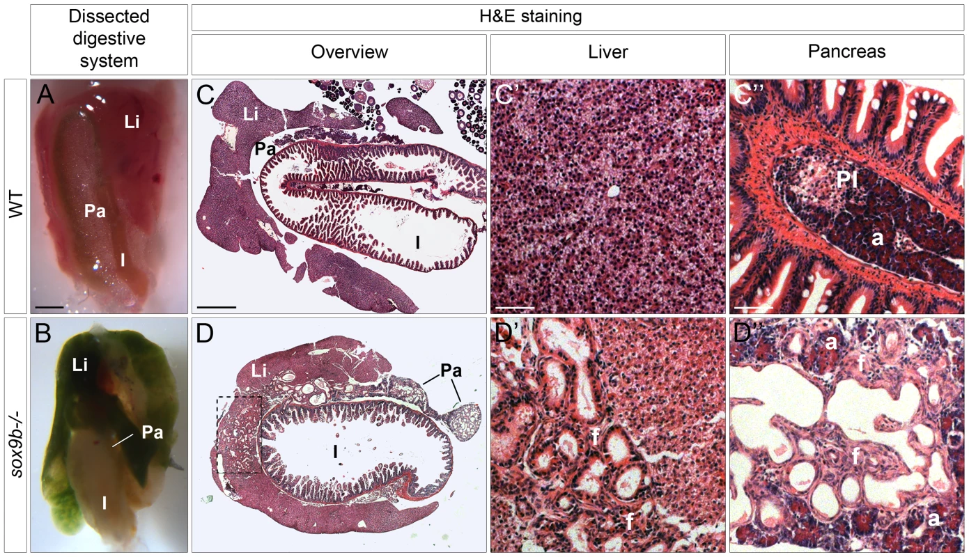 Adult <i>sox9b</i> mutants develop cholestasis associated with fibrosis, duct proliferation, and dilation in both the liver and pancreas.