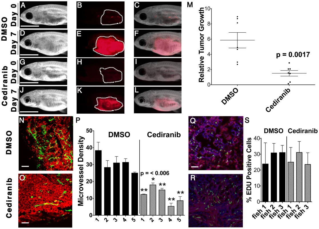 Chemical inhibition of VEGF signaling by cediranib reduces ERMS growth <i>in vivo</i>.