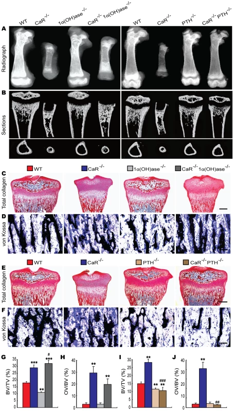 Effects of deletion of 1α(OH)ase or PTH on the skeletal development of CaR–deficient mice.
