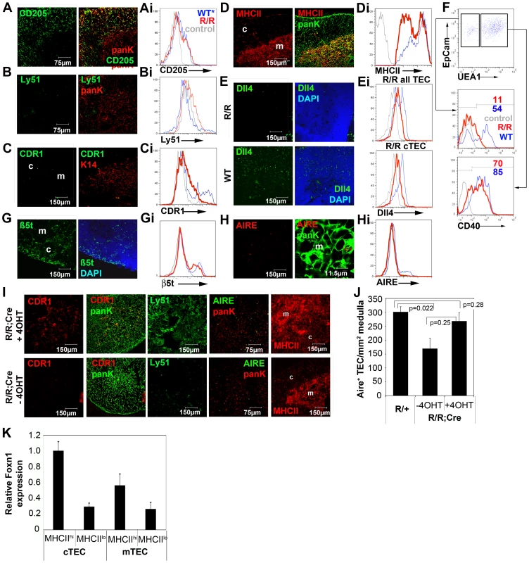 Reduced Foxn1 expression results in impaired development of both medullary and cortical TEC in postnatal <i>Foxn1<sup>R/R</sup></i> thymi.