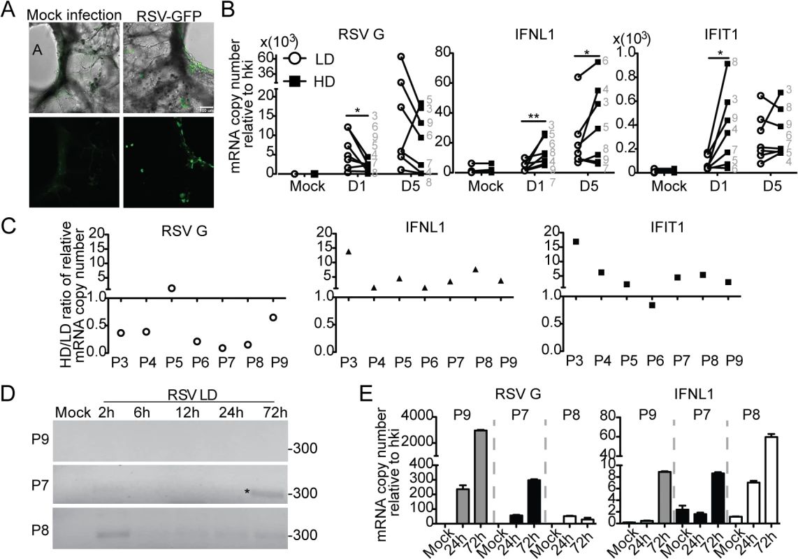 Host-intrinsic factors determine the response to iDVGs in the human lung.