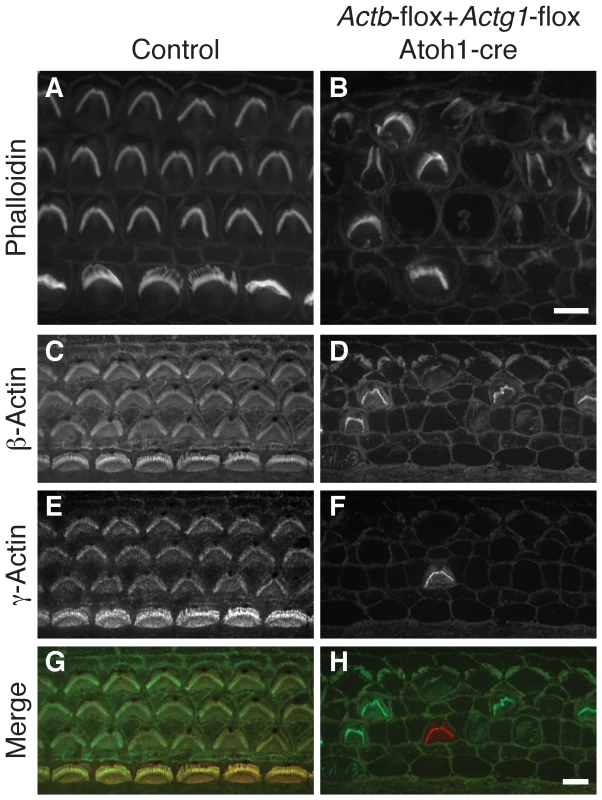 <i>Actb Actg1</i> double knockout cells do not develop stereocilia.