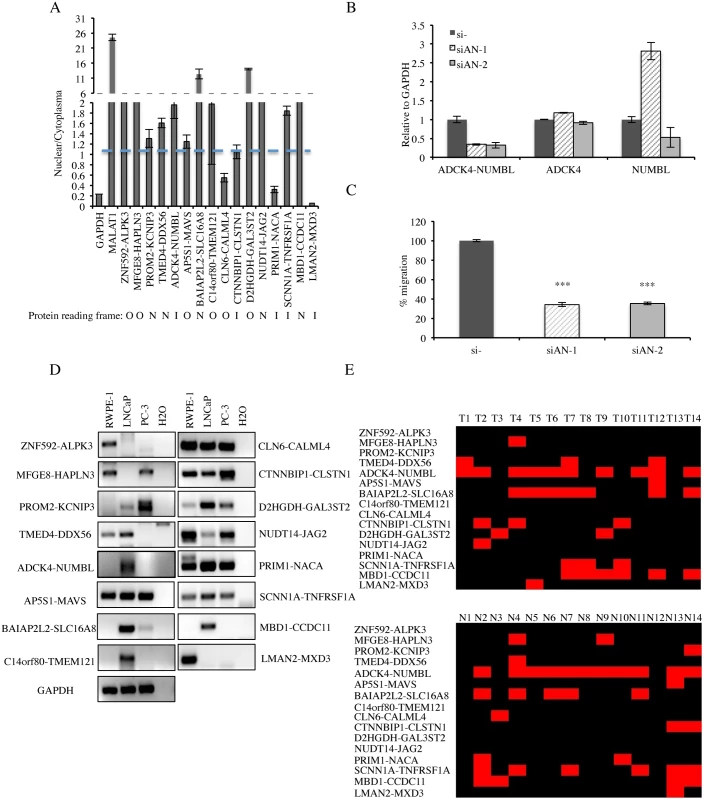 Detection of cis-SAGe chimeric mRNA in prostate cell lines and clinical tissues.
