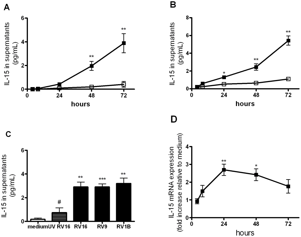 Rhinovirus infection induces IL-15 protein and mRNA production in human monocyte-derived macrophages.
