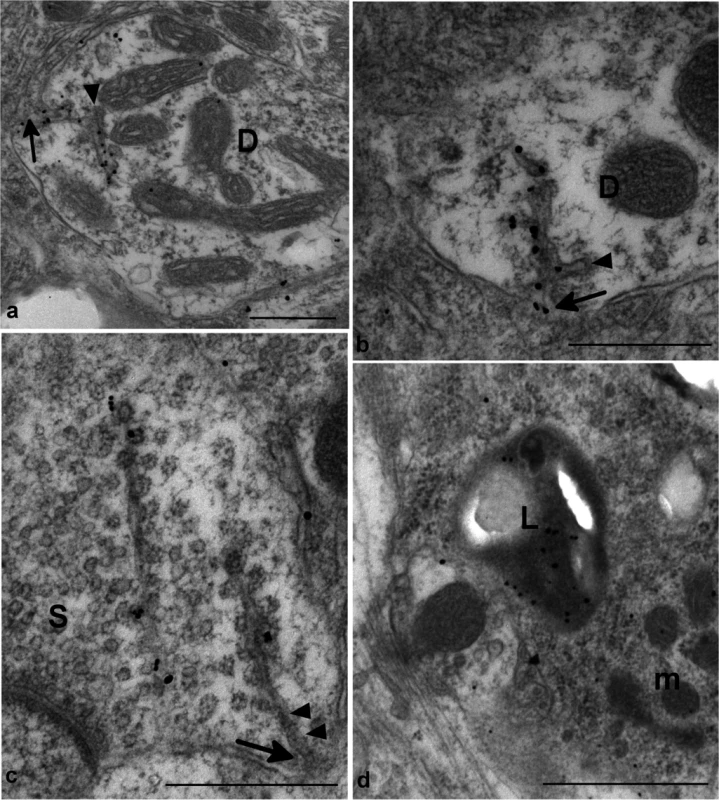 Ultrastructural changes in rec-Prion challenged CD-1 mice detected by immunogold electron microscopy.