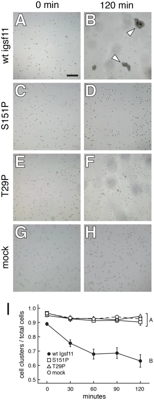 Igsf11 promotes aggregation of K562 myeloid leukemia cells in vitro.