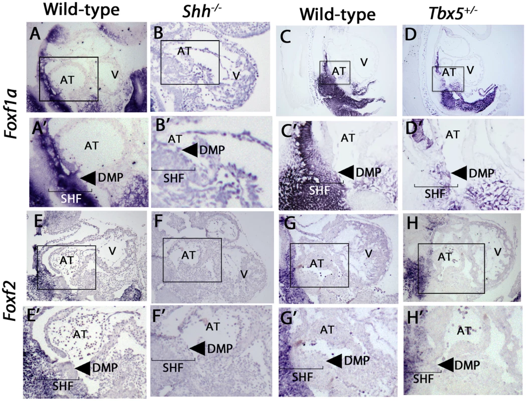 Expression of <i>Foxf1a</i> and <i>Foxf2</i> in <i>shh<sup>−/−</sup></i> and <i>Tbx5<sup>+/−</sup></i> mutants embryos at E9.5.