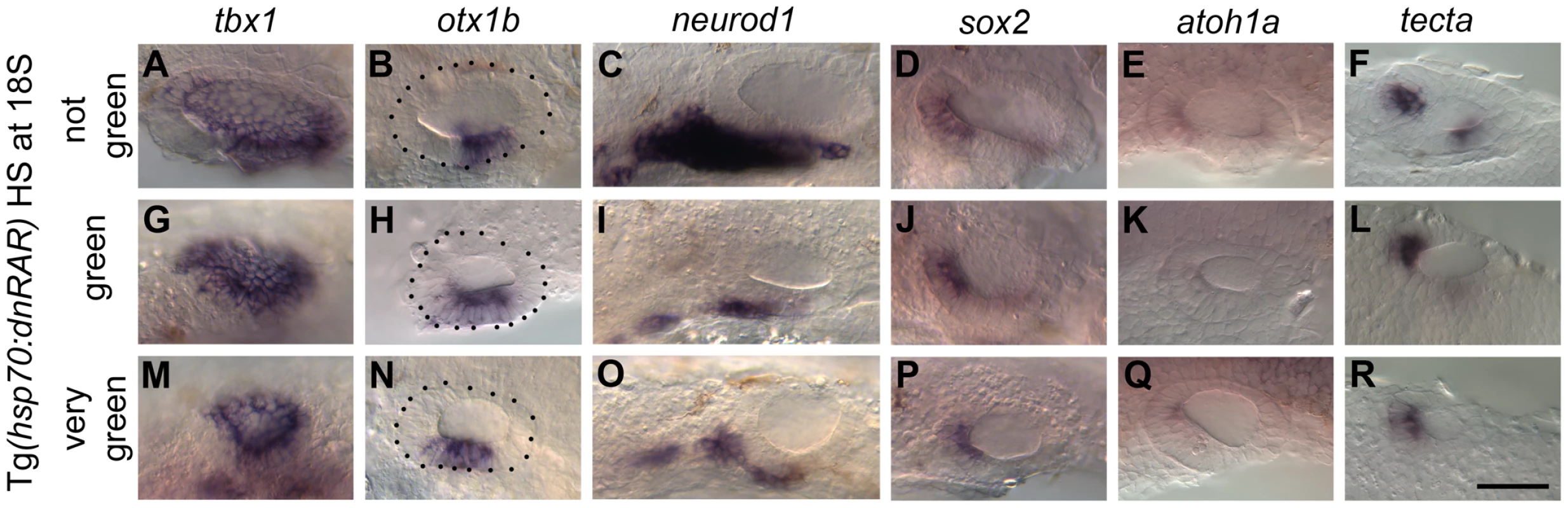 Heatshock of <i>Tg(hsp70:dnRAR)</i> embryos leads to an expansion of otic <i>otx1b</i> and a loss of <i>neurod1</i> expression.